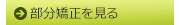 矯正時間を短く